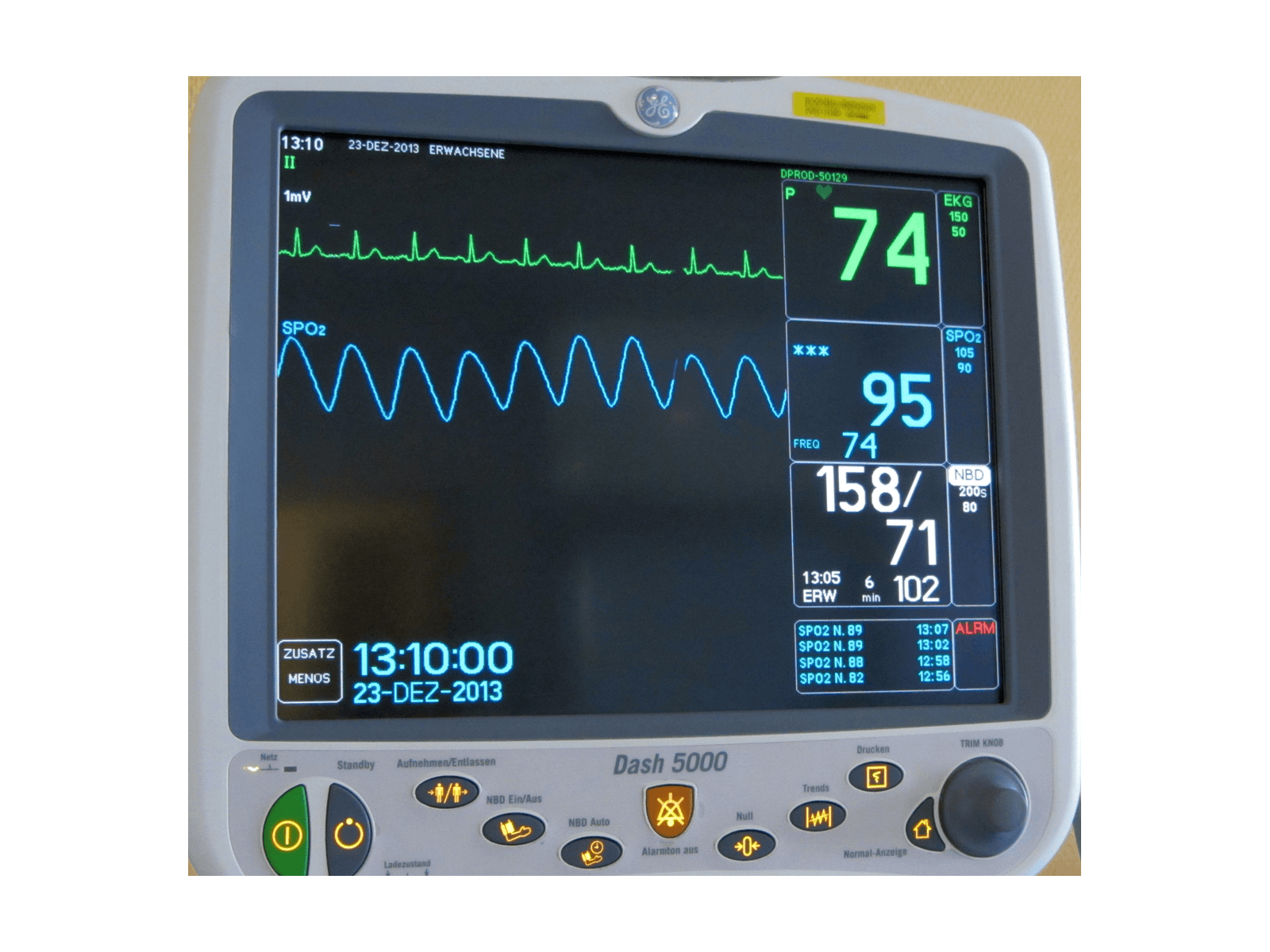 Patient monitoring equipment for critical care