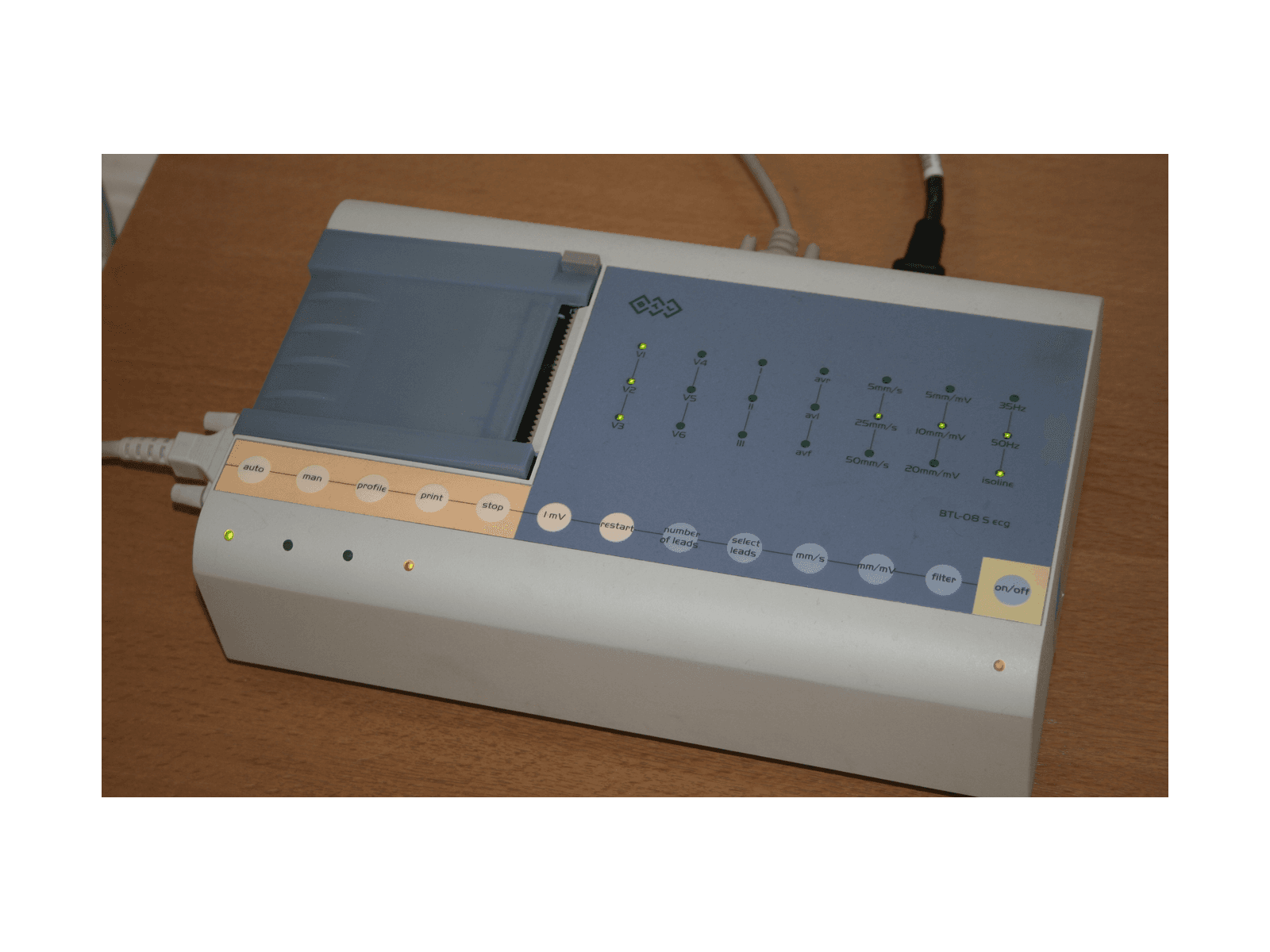 ECG diagnostic equipment
